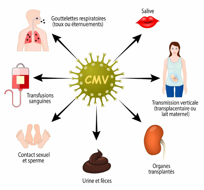 Le cytomégalovirus humain : un acteur insoupçonné dans la maladie d’Alzheimer ?